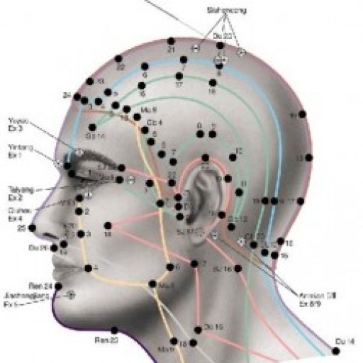 akupuntur psikis magelang