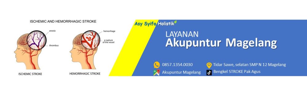 PENGOBATAN STROKE & NYERI PAK AGUS MAGELANG – WA: 0857.1354.0030