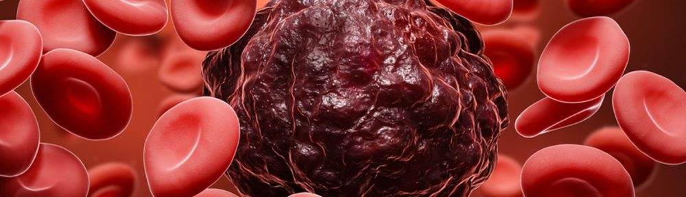 pengobatan kanker darah akupuntur magelang