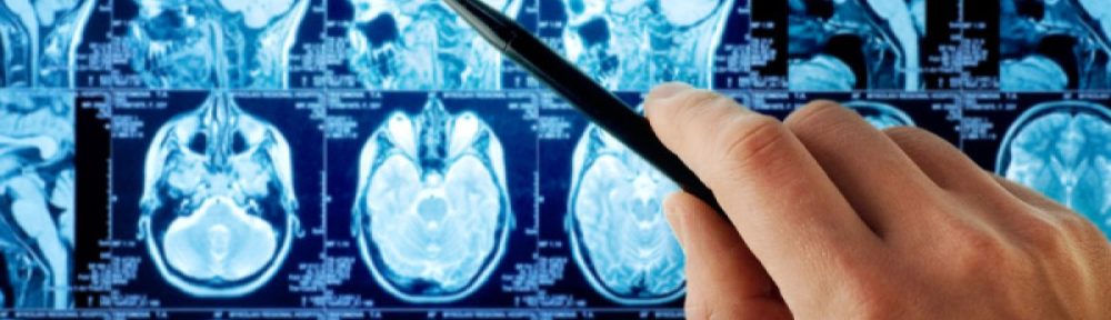 pengobatan kanker otak magelang