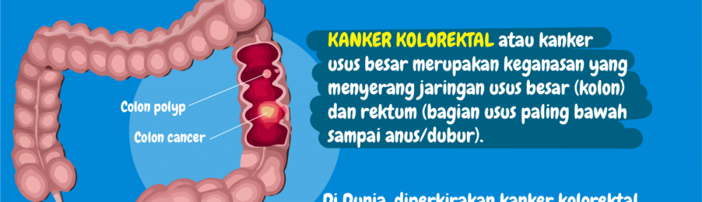 pengobatan kanker usus magelang