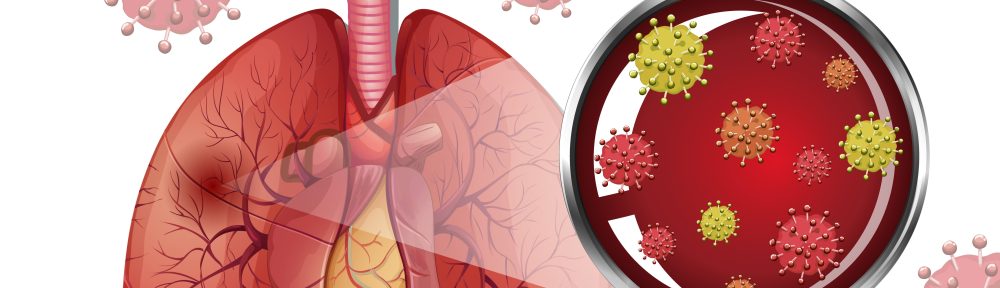 pengobatan paru paru basah dengan akupuntur magelang